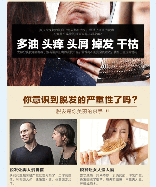  琴叶生姜洗发水防脱发控油老姜汁祛屑滋润洗发露姜王育发新老包装替换中