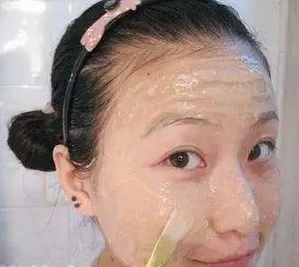  消除痘痘痘印小妙招,脸上有痘印痘坑不用愁了