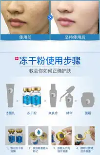  金丝玉帛多效焕活修护冻干粉微针修护淡化痘印祛痘egf因子安瓶