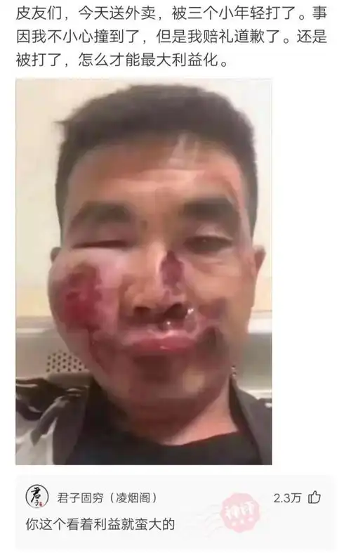  神回复今天送外卖,被三个小年轻打了,我该怎么最大利益化