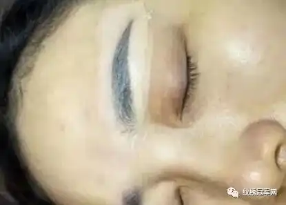  纹绣师如何淡化纹眉之后的过黑的尴尬期