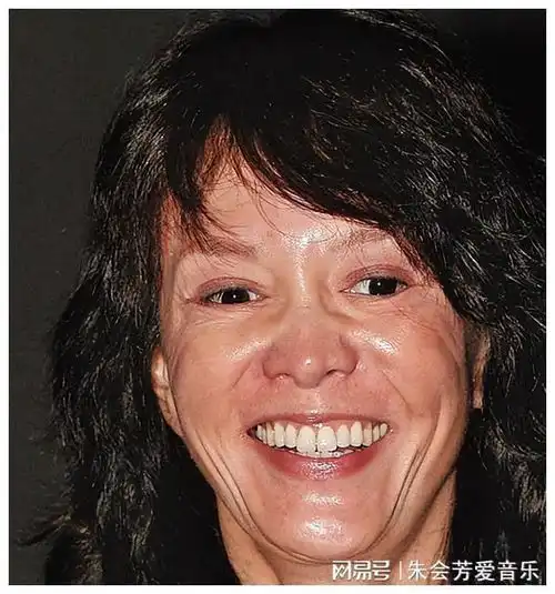  蛇精脸歪下巴面容扭曲,这五位女星整容失败面目全非,实在可惜