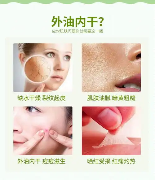  芦荟胶补水保湿祛痘淡化痘印疤痕晒后修复面膜面霜乳液女学生正品