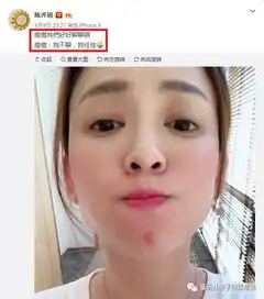  好评满满温和祛痘,淡化痘印,24h见效