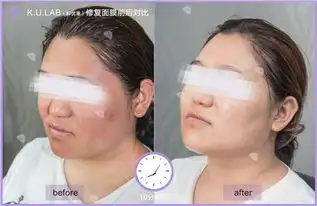  医用修复面膜哪个牌子好怎么代理