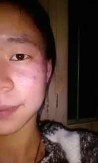  怎么淡化泪沟,天然的方法,谢谢