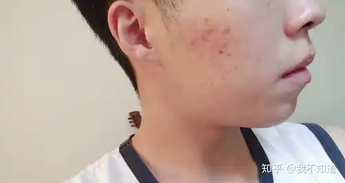  一个超好的学生党专用平价护肤品