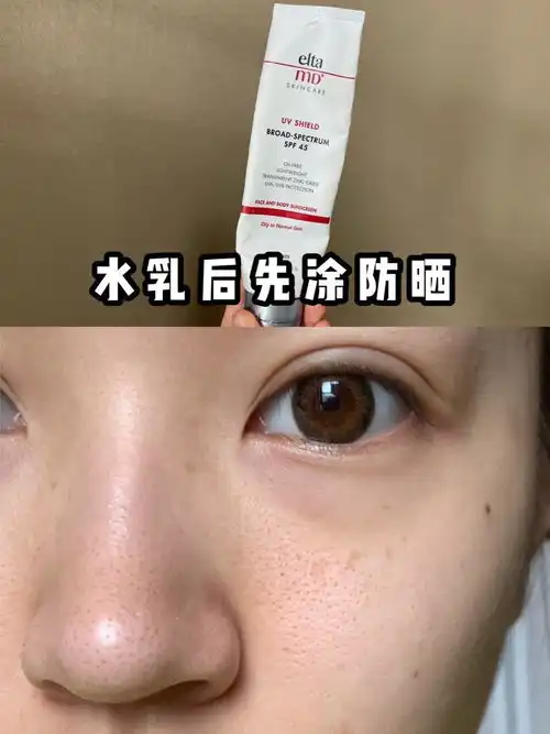  想请教各位仙女毛孔粗大的不行该怎么快速恢复零毛孔医美吗