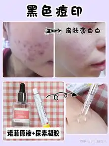  如何去痘印
