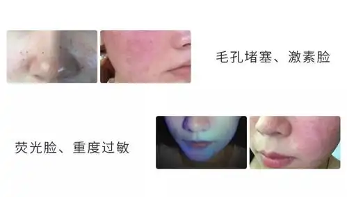  自用款回购10次的美白去黄面膜,用完白一个色号,还能先试后买