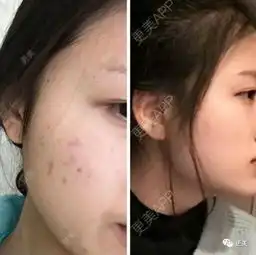  半个贵圈女星争c位,baby美,娜扎靓,她却因发胖畏缩遭群嘲