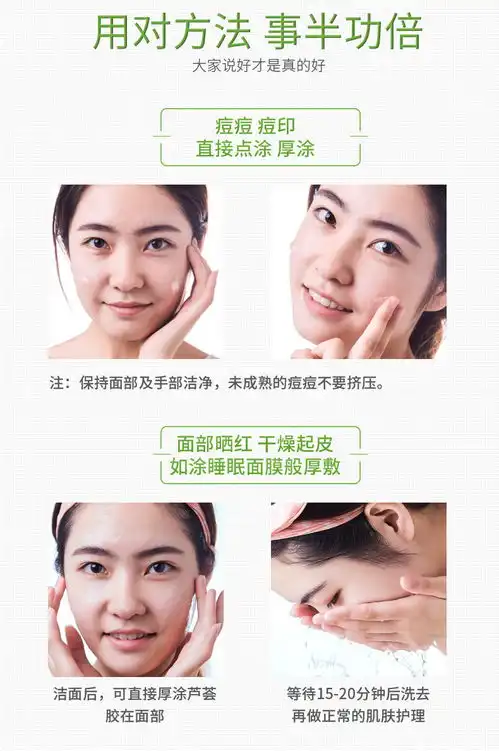 芦荟胶补水保湿祛痘淡化痘印疤痕晒后修复面膜面霜乳液女学生正品