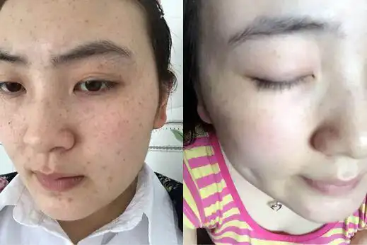  淡化唇色,唇部护理该怎么做