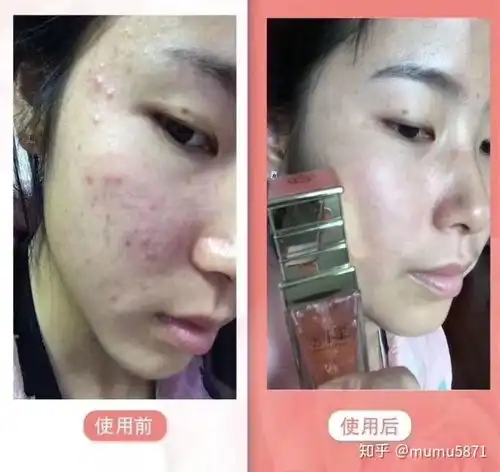  哪些牌子的护肤品好用呢