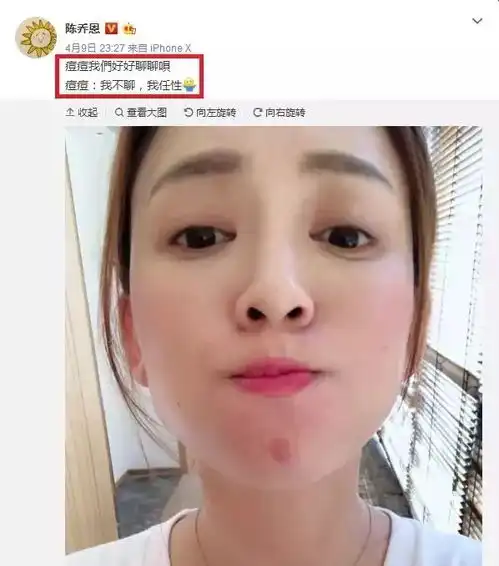  祛痘用它24小时抚平痘痘,还能淡化痘印美白嫩肤
