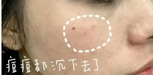  这个大牌破产了面膜一片不到2元,抢不到真的会哭