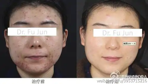  最全的医美面膜大测评,你想知道的全都有