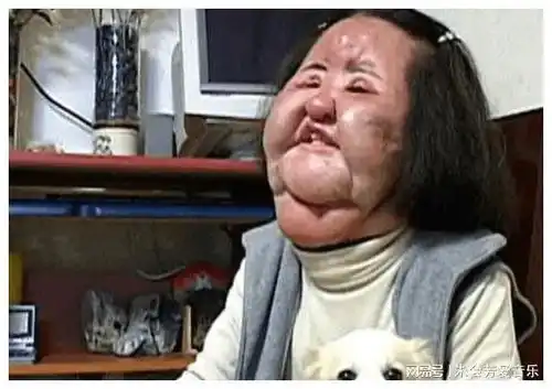  蛇精脸歪下巴面容扭曲,这五位女星整容失败面目全非,实在可惜