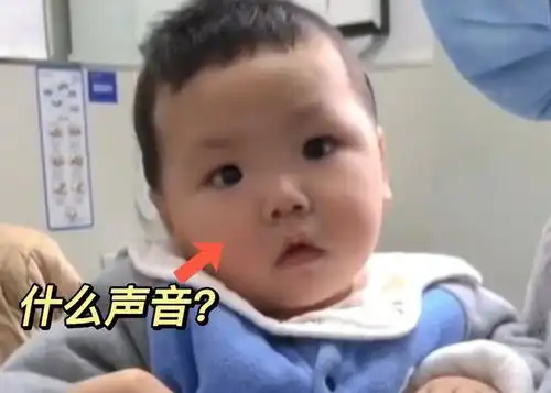  陕西失聪宝宝第一次听到声音,表情让人泪目网友科技的力量