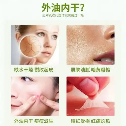  正品萃汇尔芦荟胶补水保湿祛痘淡化痘印疤痕晒后修复面膜面霜乳液