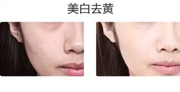  每天一次,美白祛斑淡化痘印收缩毛孔,素颜也能白得耀眼