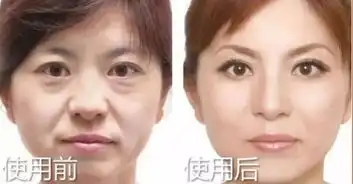  北上广正在悄悄流行的祛斑神器