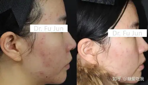  最全的医美面膜大测评,你想知道的全都有