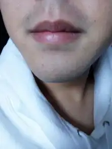  胡子刮完了之后嘴唇很青,怎么能淡化