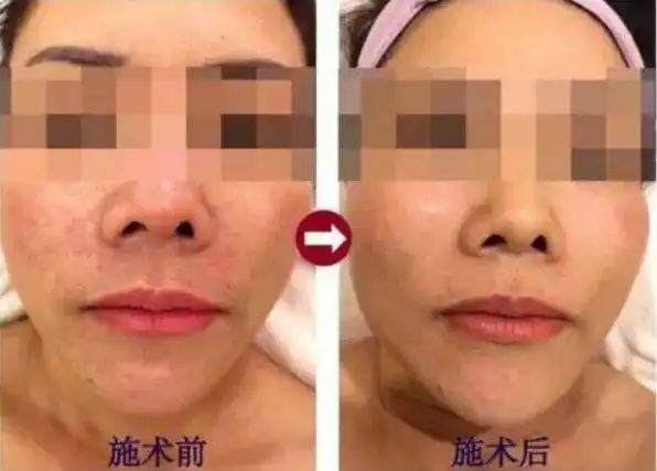  逆天了聊城仙女夸爆的美容圣地,让你重塑夏日少女肌肤,带你走上颜值巅峰